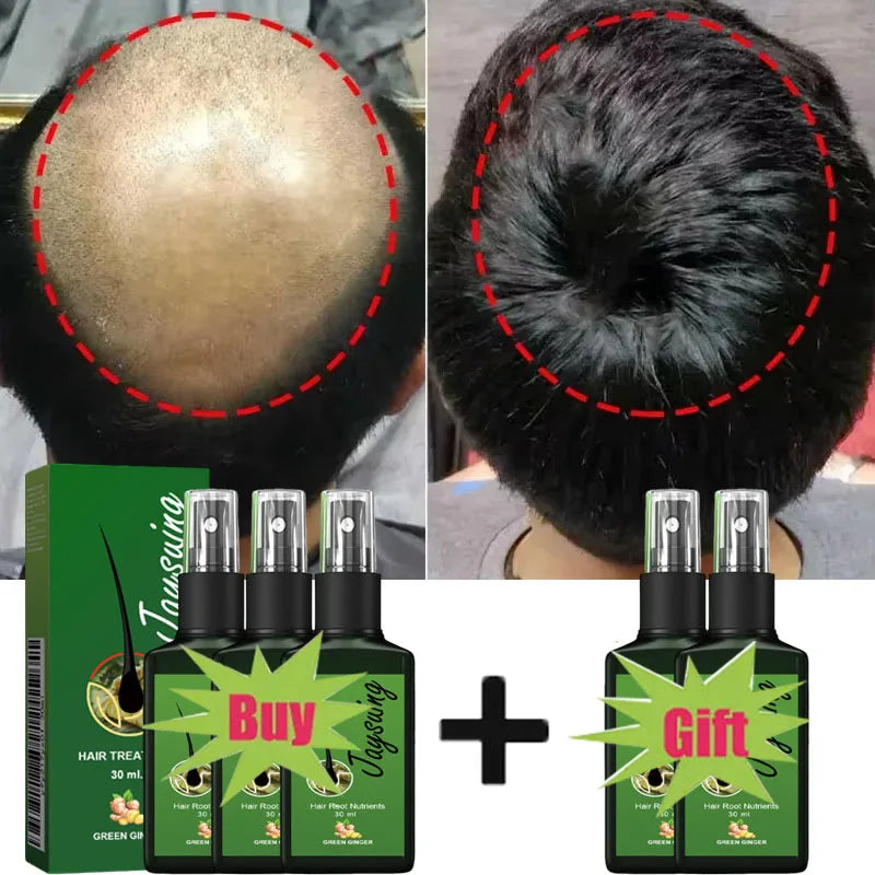 Fast Hair Growth Serum Spray | Anti Hair Loss & Baldness Treatment for Men & Women