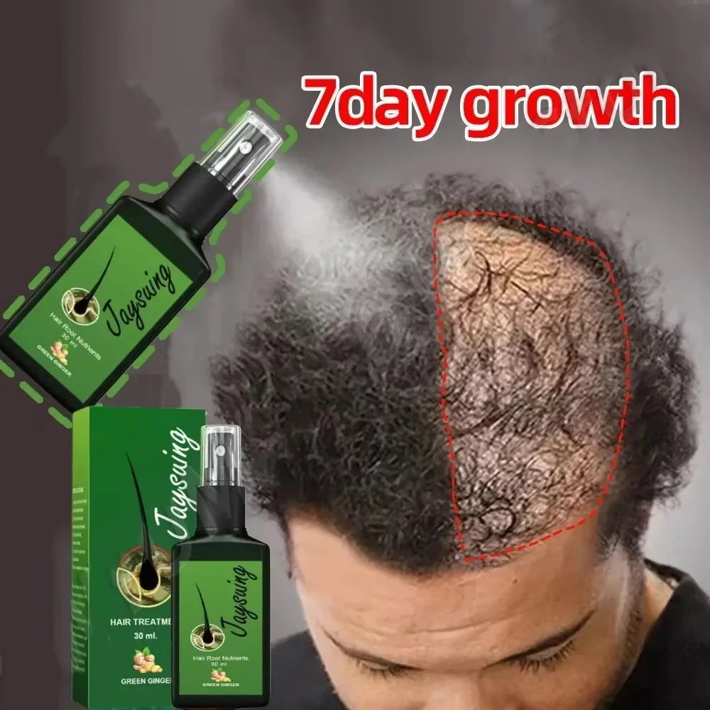 Fast Hair Growth Serum Spray | Anti Hair Loss & Baldness Treatment for Men & Women