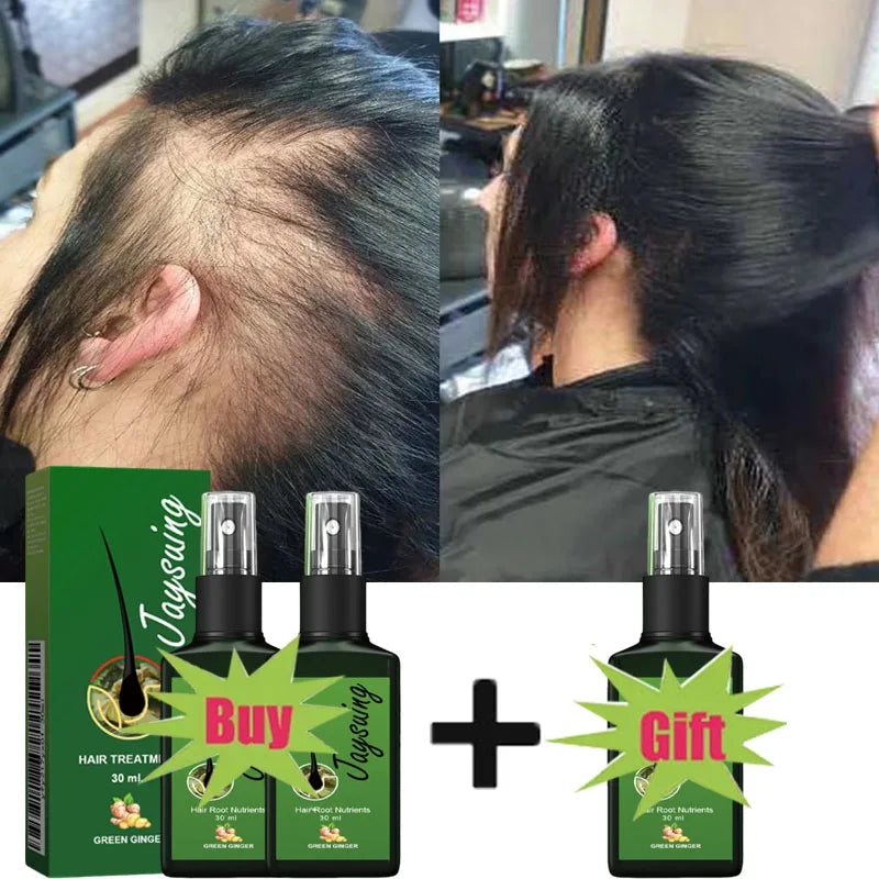 Fast Hair Growth Serum Spray | Anti Hair Loss & Baldness Treatment for Men & Women