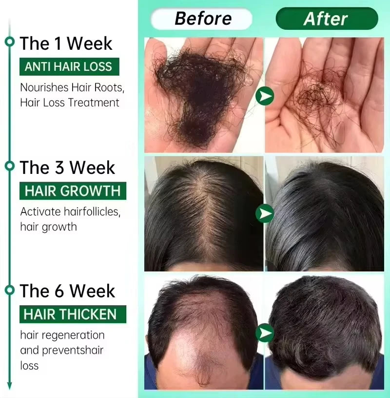 Fast Hair Growth Serum Spray | Anti Hair Loss & Baldness Treatment for Men & Women